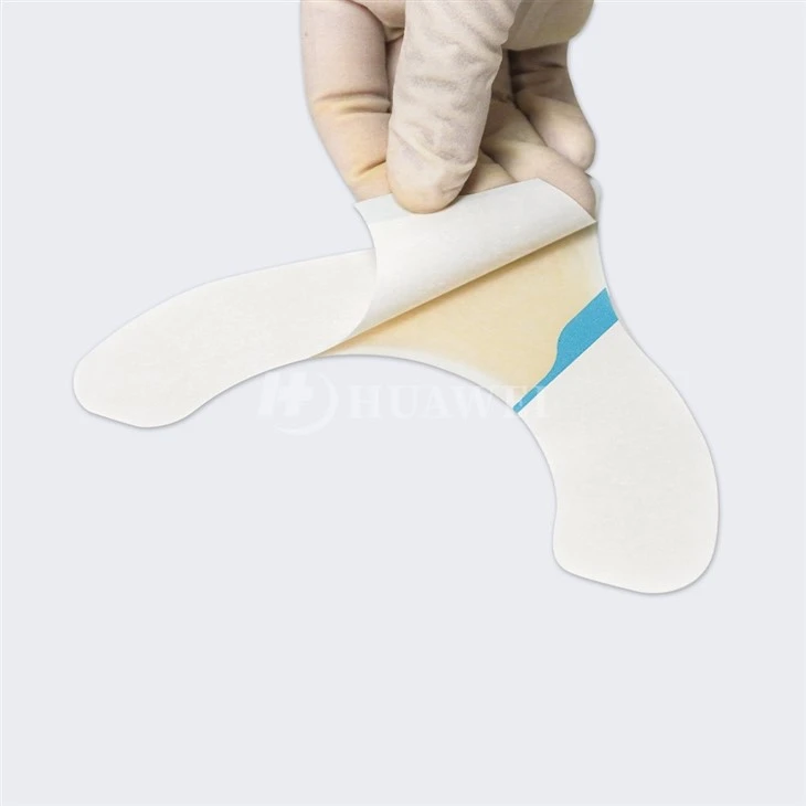 Hydrocolloid Extenders Ostomy Barrier Strips best