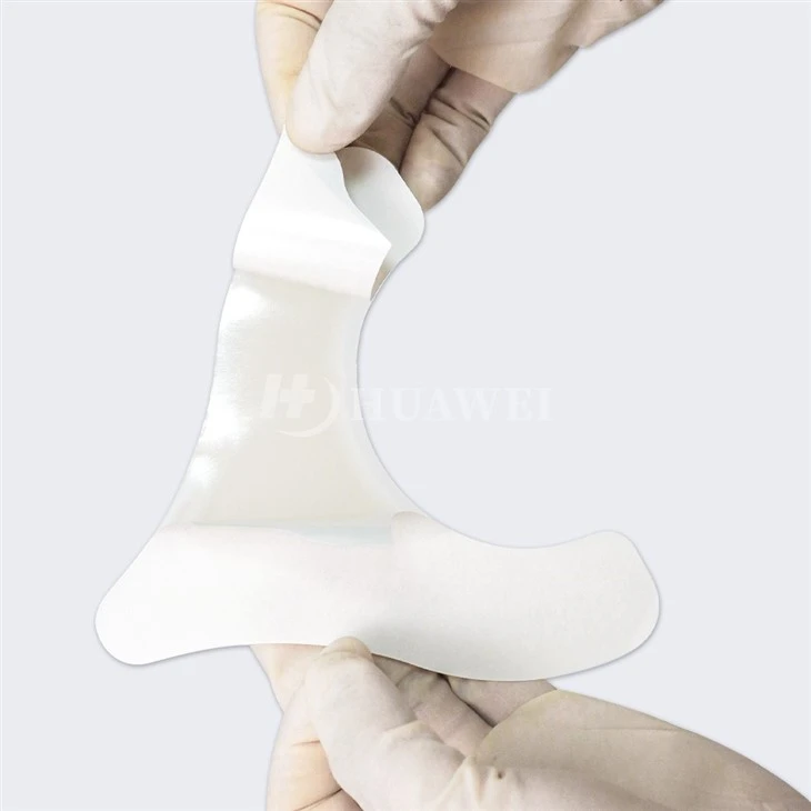 Hydrocolloid Extenders Ostomy Barrier Strips suppliers