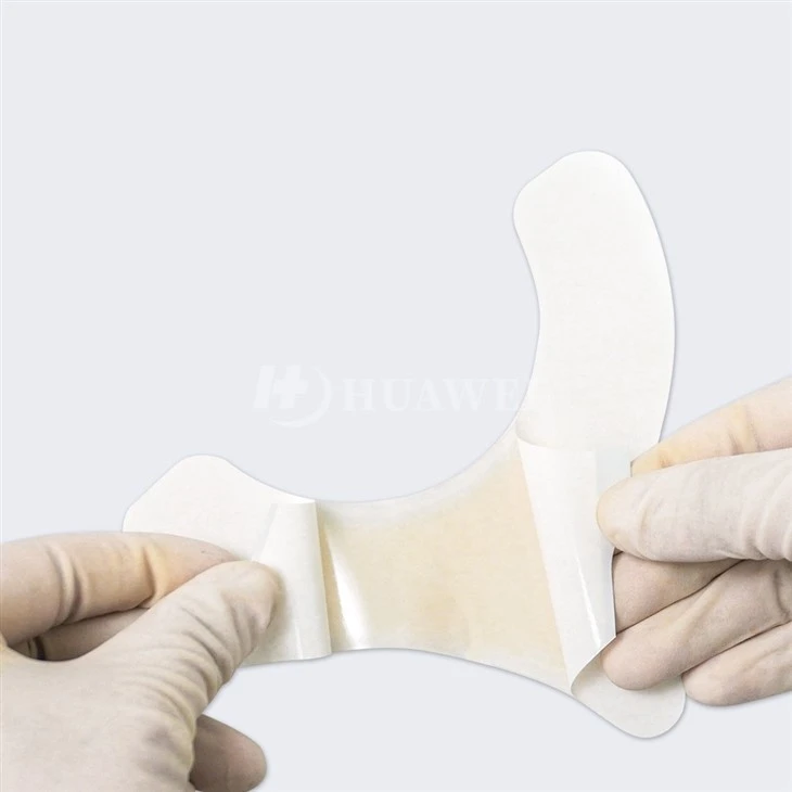 Hydrocolloid Extenders Ostomy Barrier Strips factory